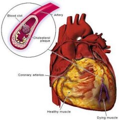 How a detox diet can prevent heart disease