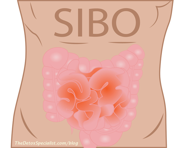 intestinal candida, SIBO 